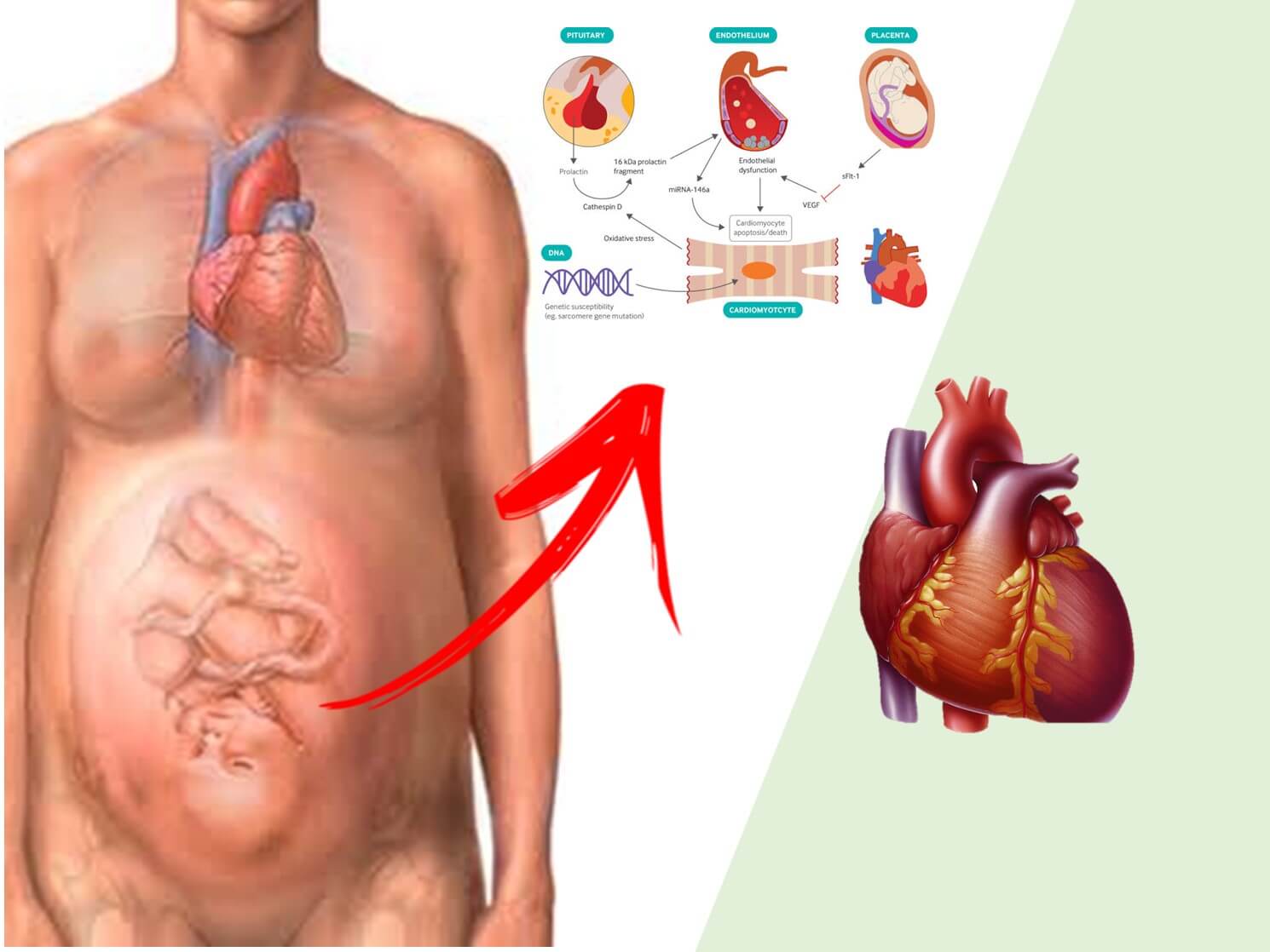 16 pontos-chave da Cardiomiopatia Periparto - CardioSite